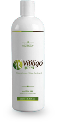 Vitiligo Green 8oz (236ml)+ Free Shipping