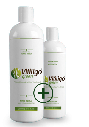Vitiligo Green-Hottest Special Deal - Buy 1 Get 1 Free (8+4 oz)+Free shipping - Save $125